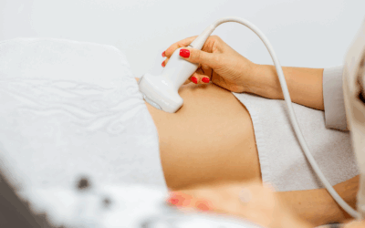 Why You Need an Ultrasound Before Abortion